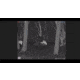 ATN BlazeTrek-325 2.7x - 21x Thermal Imaging Monocular 12 Micron, 384x288, Black, TIMNBLT325